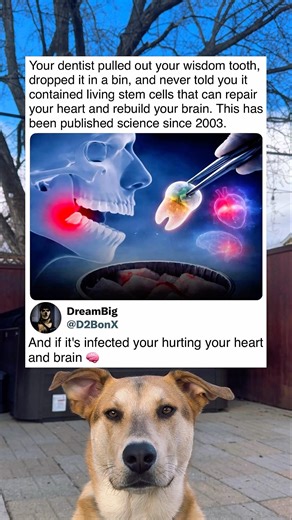 What Dentists Don’t Tell You About Wisdom Teeth