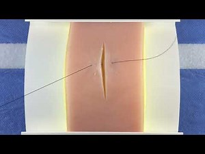 Horizontal Mattress Suture