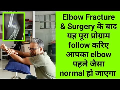 elbow fracture & surgery physiotherapy exercises - complete rehabilitation program - full recovery