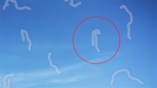 Seeing Spots? It Could Be Eye Floaters, Here Is Why It Is Caused