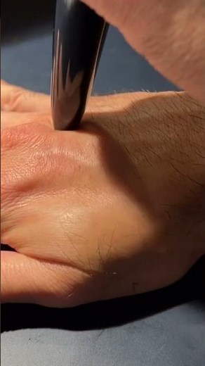 How to self treat RA finger joints swollen pain