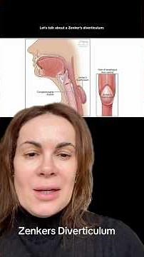 Zenker’s Diverticulum Exam Review (Tutor Breakdown)