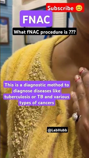 Fine needle aspiration cytology #fnac #fnac procedure #pathology #microscopyworld #diseasedetection