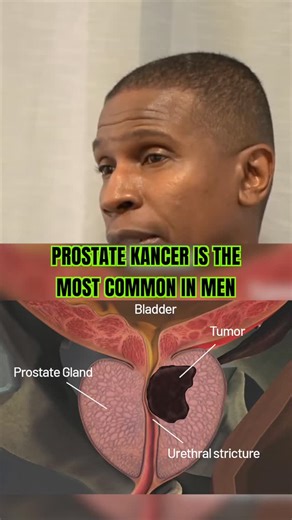 Dirty Roots™ on Instagram: "TAKE THESE HERBS TO PROTECT THE PROSTATE"