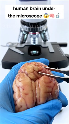 इंसान का दिमाग़ under the microscope 🔬🤯 #shorts #facts #microscope #millionaire #amazingfacts #trend