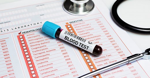 Cómo saber si tengo anemia: los primeros síntomas de alerta