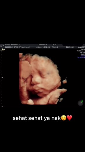 Understanding Fetal Development through Ultrasound Images