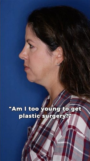 Am I Too Young for a Facelift? 48-Year-Old Deep Plane Facelift Before & After