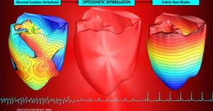 Painless light pulses, instead of harsh electric shocks, shown to restore heart rhythms