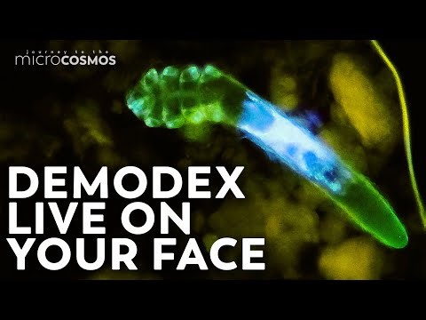 A scientist scraped a black dot on his forehead and filmed it under a microscope, revealing dozens of crawling face mites