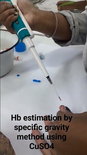 Hb estimation by specific gravity method using CuSO4..