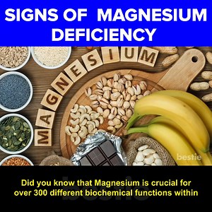 11K views · 440 reactions | 16 Clear Signs Of Magnesium Deficiency You Should Not Ignore #MagnesiumDeficiency #MagnesiumDeficiencySymptoms #Bestie Sources: https://pastebin.com/za5y5XEf | Bestie | Facebook