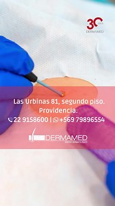 ⚡¿Para qué realizar una biopsia de piel?⚡ 👉La biopsia en dermatología es un procedimiento donde se extraen muestras de tejido para analizarlas en un laboratorio. ☝La finalidad de una biopsia es poder diagnosticar enfermedades y afecciones cutáneas como: 📌Cáncer de piel, como carcinoma basocelular, carcinoma espinocelular y melanoma. 📌Lunares sospechosos y tumores. 📌Infecciones de la piel. 📌Verrugas. 📌Papiloma humano. 📌Psorisis, dermatitis, enfermedades infamatorias de la piel, entre otras