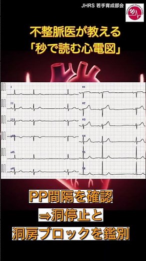 【不整脈医が教える「秒で読む心電図」】