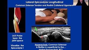 Elbow Anatomy, Scan Techniques, and Normal Ultrasound Characteristics