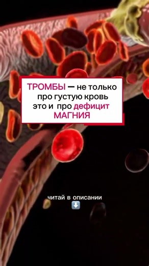 Думаешь, тромбы появляются только от «густой крови»?