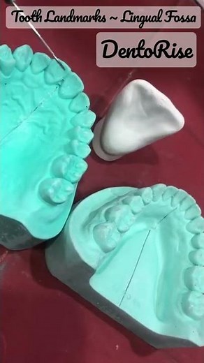 Landmarks on tooth surfaces | LINGUAL FOSSA | Short video LINK IN DESCRIPTION | Dental Anatomy