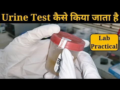 Urine Test Kaise Kiya Jata hai, Urine R/M (Routine and Microscopy), Urine Test Procedure & Report