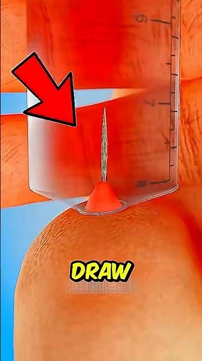 If you ever get a splinter, NEVER pull it out like this
