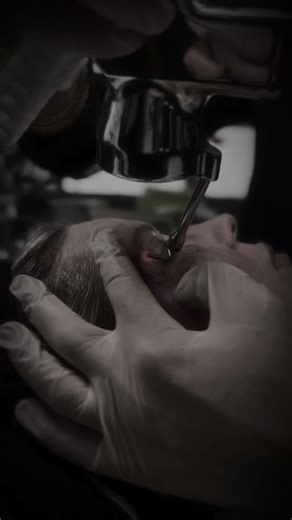 The Laser Eye Lift with ProFractional ✨️ No surgery. No shortcuts....