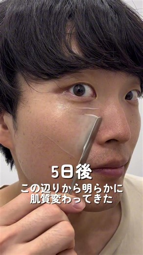 鼻ダニ撃退方法！モテたいやつは絶対に肌は綺麗にした方がいい！#毛穴ケア #黒ずみ #美容液 #角栓 #スキンケア pr