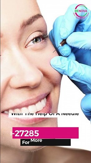 What is Milia? | Tiny White Bumps on Skin Explained