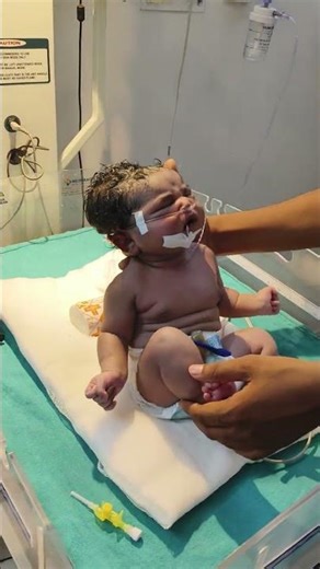 Baby ka head swelling hai?#deliverylife #cutebaby #heavy #weight