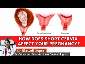 How does Short Cervix affect your pregnancy ? Causes, Diagnosis & Treatment | Healing Hospital