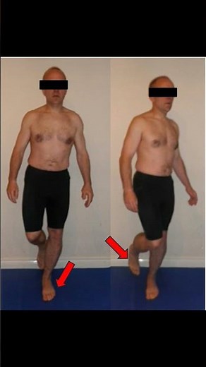 Corkscrew Test | Trunk & Lower Limb Stability Check | #meded #spine #chiropractor #physiotherapy