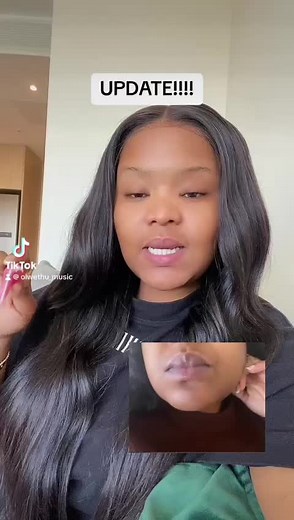 Pink Lips Review Update: Results, Before and After, Where to Buy