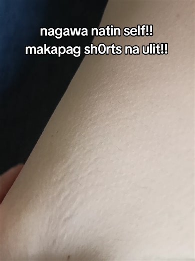 Effective Stretch Mark Solutions with Organic Skin Oils