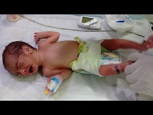 Newborn Baby Check-Up | RBS Monitoring & Physiotherapy Oil Massage Care feeding trial