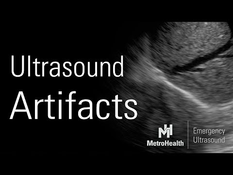 Ultrasound Artifacts