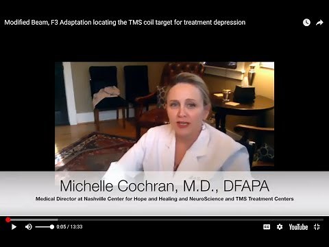 Modified Beam, F3 Adaptation locating the TMS coil target for treatment depression