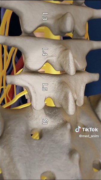 Lumbar fusion #fyp #3danimation #meditok