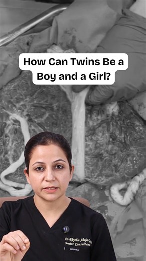 How Can Twins Be a Boy and a Girl? 👶👶 Dr Rhythm Gupta - Infertility and IVF specialist at Excel IVF
