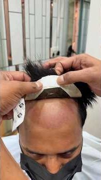 Hair Patch Self Service at Home | Perfect Front Hairline Finishing #hairpatch #hairfixing