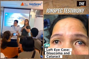 242K views · 1.1K reactions | IonSpec medical glasses from MGI are...