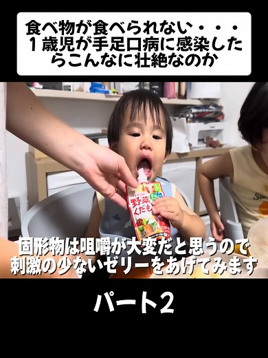 手足口病に感染した1歳児の壮絶な日常