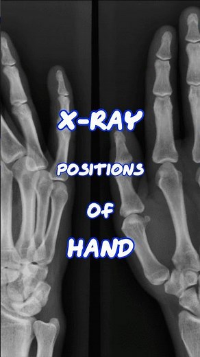 X-ray positions of hand | x-ray positions #anatomy #xray #radiology #shorts