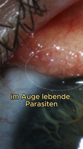 Unglaubliche Dinge im menschlichen Körper gefunden 😳 #unglaublich #geschichte #echte