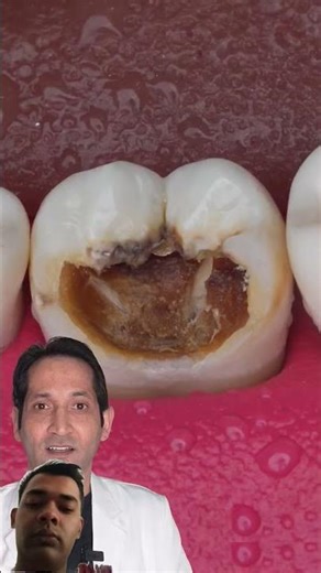 Tooth modeling looks maxing