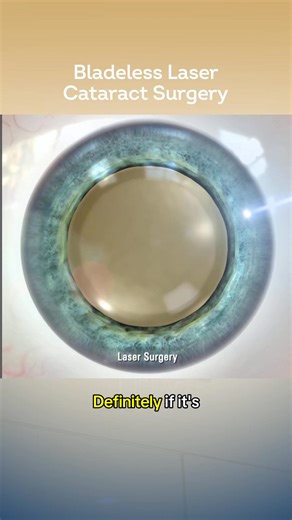 109K views · 449 reactions | Why is it #BetterBladeless?  Dr. Ches...