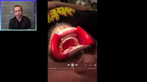  How Are Braces Removed? Have you ever wondered what the process is...