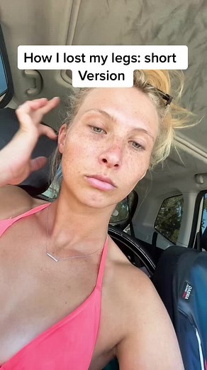 A little story while I figure out how to open my car door to put my leg back on with traffic two feet away from me😬🤔 #amputee #storytime #fyp #accident #walking #tomorrow #fyp #questions #summer #highway #sendhelp #lol #wheelchairtok #leglesslizard