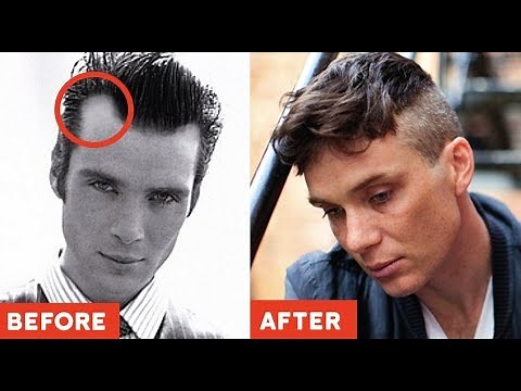 11 GENIUS Hairstyles TO HIDE Receding Hairlines / Big Foreheads (2019 Styles ONLY)