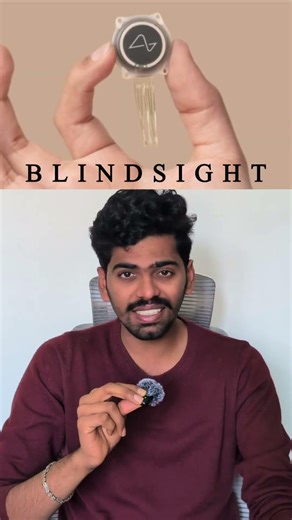 Blindsight chip in telugu. Neuralink chip deoded #neuralink #elonmusk #smartfolio