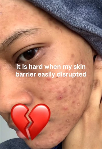 The Hydrating Benefits of Panthenol for Sensitive Skin