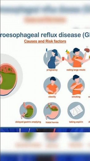 Acid Reflux Triggers