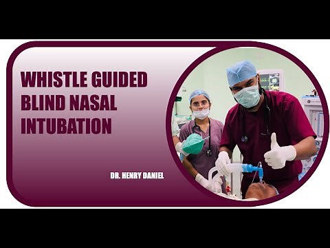 WHISTLE GUIDED BLIND NASAL INTUBATION | HENRY DANIEL | ANAESTHESIOLOGY | GMC AKOLA